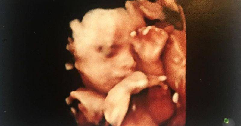 Instagram/ariskaputripertiwii